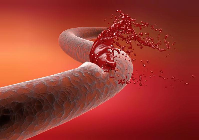 Dùng Abelacimab Trước Thủ Thuật Có An Toàn Không?