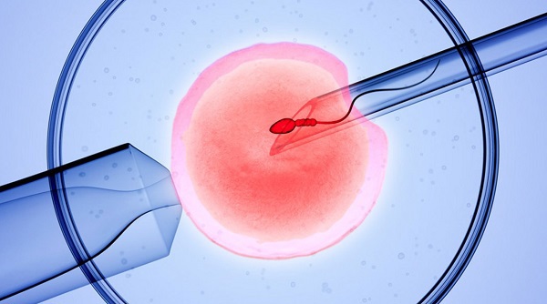 Quá Trình Làm Phương Pháp IVF Mất Bao Lâu?