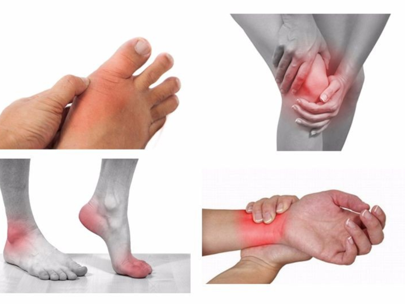 5 Bệnh Thường Gặp Trong Ngày Mưa Bão Nên Lưu Ý