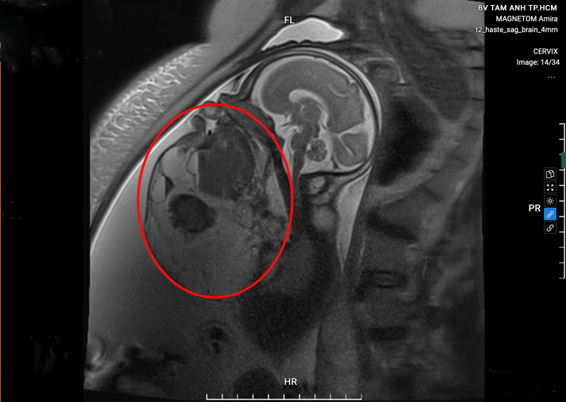 Phụ nữ mang thai có chụp MRI được không?