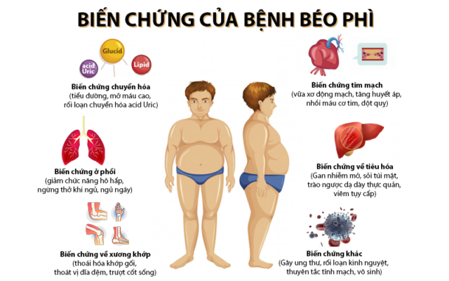 Cảnh báo từ nghiên cứu: Béo phì có thể sẽ gây ra 700.000 ca ung thư mới  vào năm 2035 