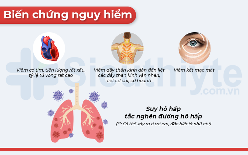 Bệnh Bạch Hầu và Tác Động của Nó Đối Với Sức Khỏe