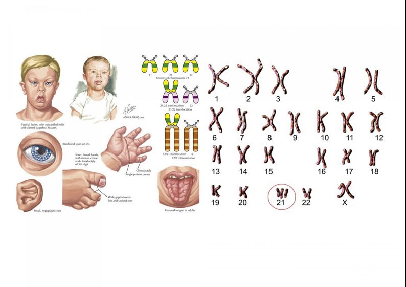 Chi phí xét nghiệm NIPT và những điều cần lưu ý