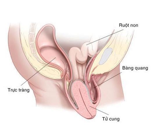 Sa tử cung có chữa được không?