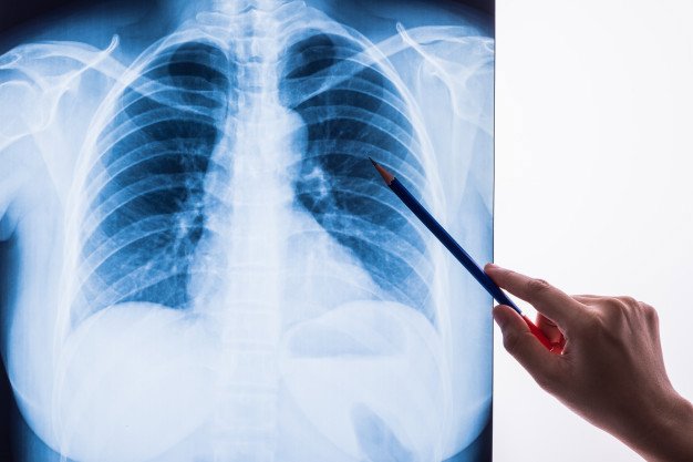 Chụp X-quang ảnh hưởng tới sức khỏe như thế nào?