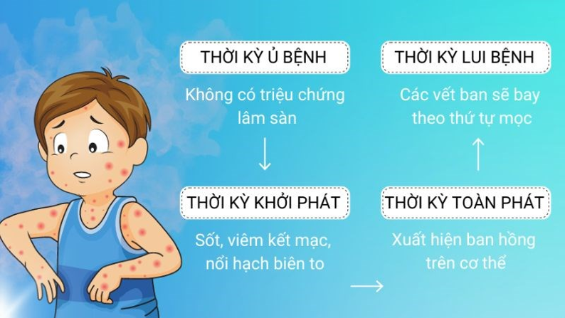 Phòng ngừa bệnh sởi: bảo vệ trẻ trẻ trước sự tấn công của sởi