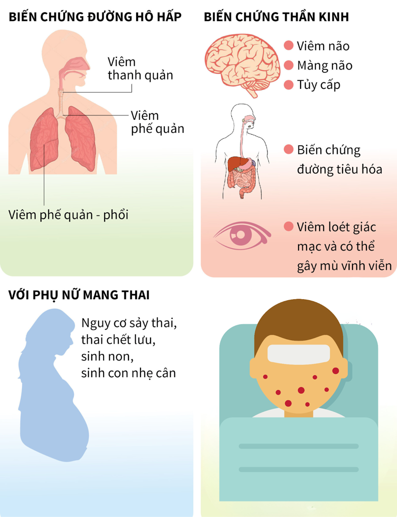 Phòng ngừa bệnh sởi: bảo vệ trẻ trẻ trước sự tấn công của sởi