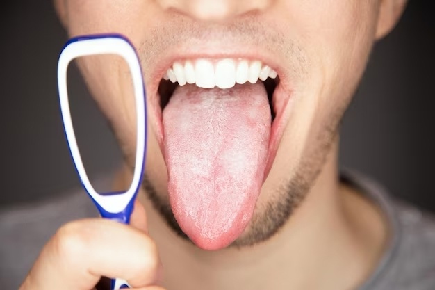 Cạo lưỡi có thực sự giúp ngăn ngừa hôi miệng?