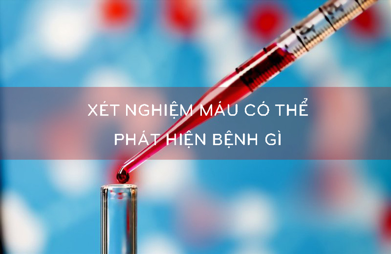 Xét nghiệm máu có mấy loại, giúp phát hiện bệnh gì?