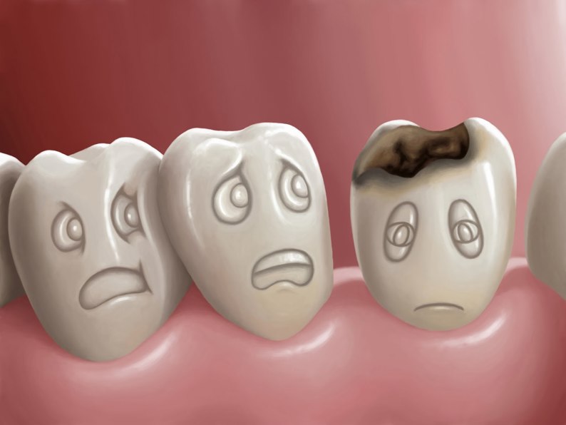 Bệnh lý răng miệng thường gặp