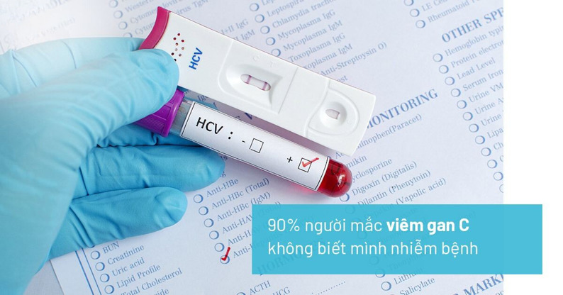 Viêm Gan Siêu Vi: Nguyên Nhân, Triệu Chứng và Phương Pháp Điều Trị