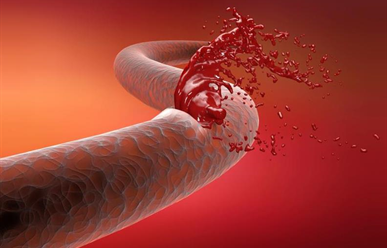 Dùng Abelacimab Trước Thủ Thuật Có An Toàn Không?