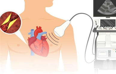 Siêu âm tim có phát hiện bệnh mạch vành? Bệnh có chữa khỏi được không?