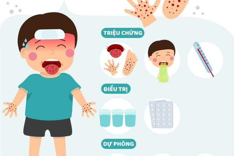 Cảnh báo: Bệnh tay chân miệng ở trẻ nhỏ đang tăng nhanh tại TP.HCM