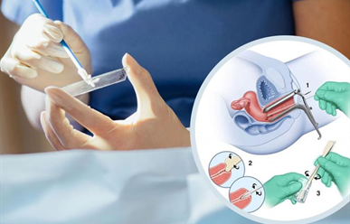  [Cập Nhật 2025] Xét Nghiệm Ung Thư Cổ Tử Cung: Các Phương Pháp, Quy Trình Và Lưu Ý Quan Trọng
