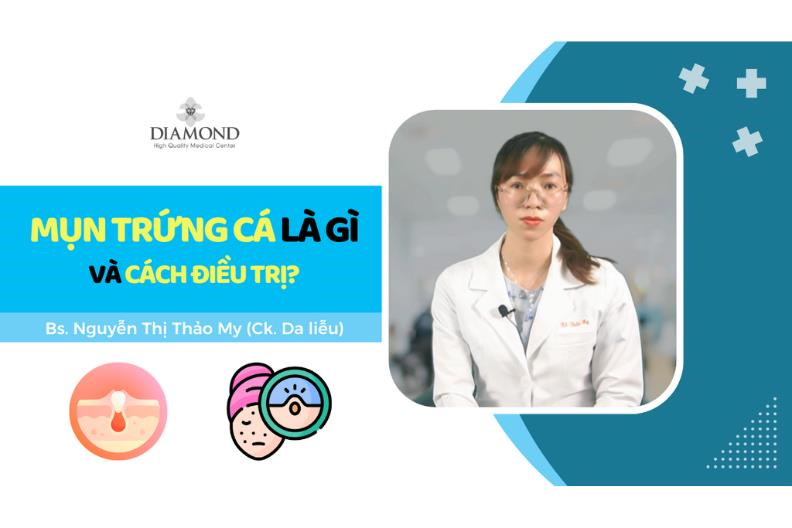 Nguyên nhân nổi mụn trứng cá và cách điều trị
