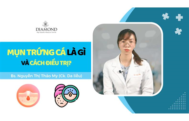 Nguyên nhân nổi mụn trứng cá và cách điều trị