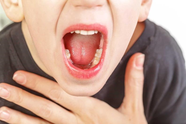 Có những bài thuốc tự nhiên nào giúp làm dịu triệu chứng nhiệt miệng ở cuống lưỡi?
