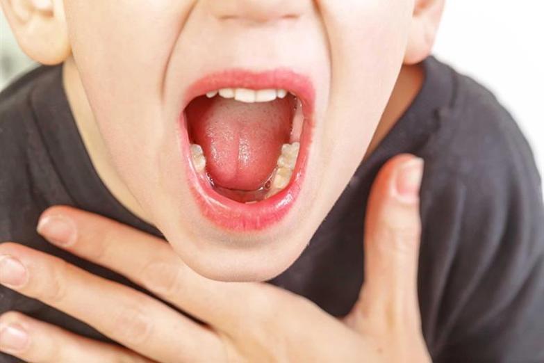 Cuống lưỡi nổi mụn đỏ có gây đau không?
