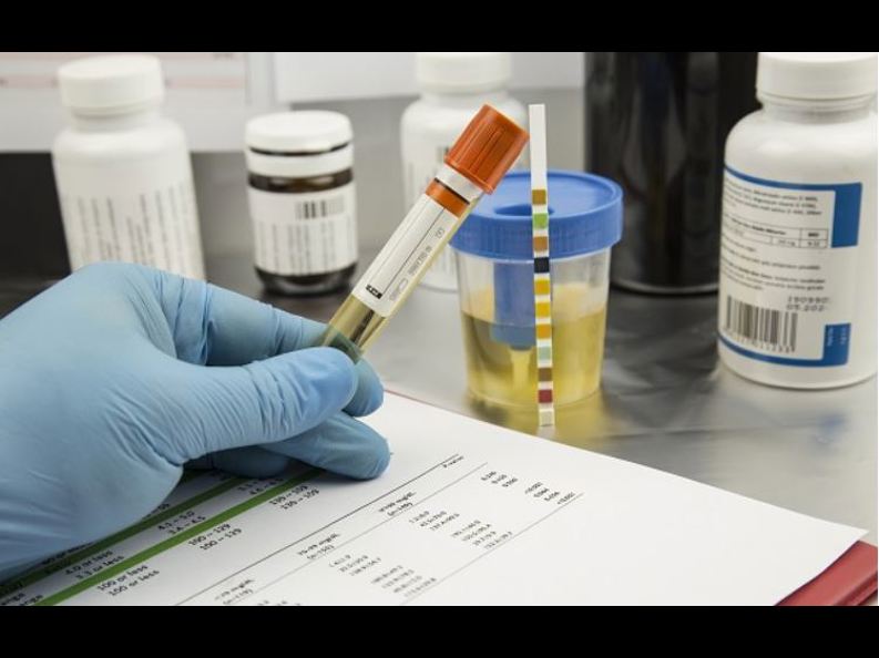 Xét nghiệm - Tổng phân tích nước tiểu