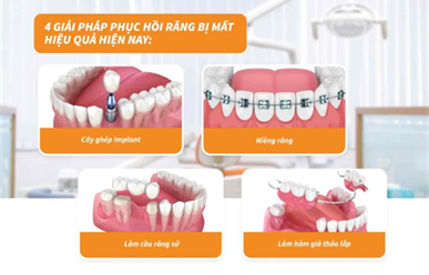 Các Giải Pháp Phục Hồi Răng Bị Mất Hiệu Quả Nhất Hiện Nay