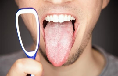 Cạo lưỡi có thực sự giúp ngăn ngừa hôi miệng?