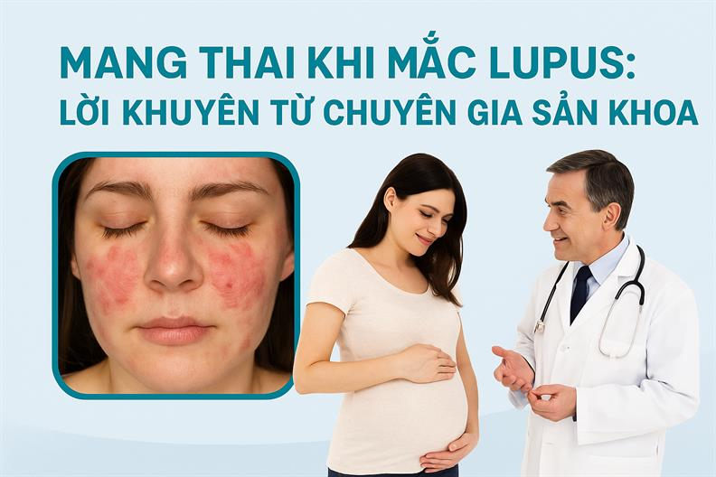 Phụ nữ mang thai mắc lupus ban đỏ hệ thống: Cần chuẩn bị gì để an toàn?
