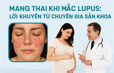Phụ nữ mang thai mắc lupus ban đỏ hệ thống: Cần chuẩn bị gì để an toàn?