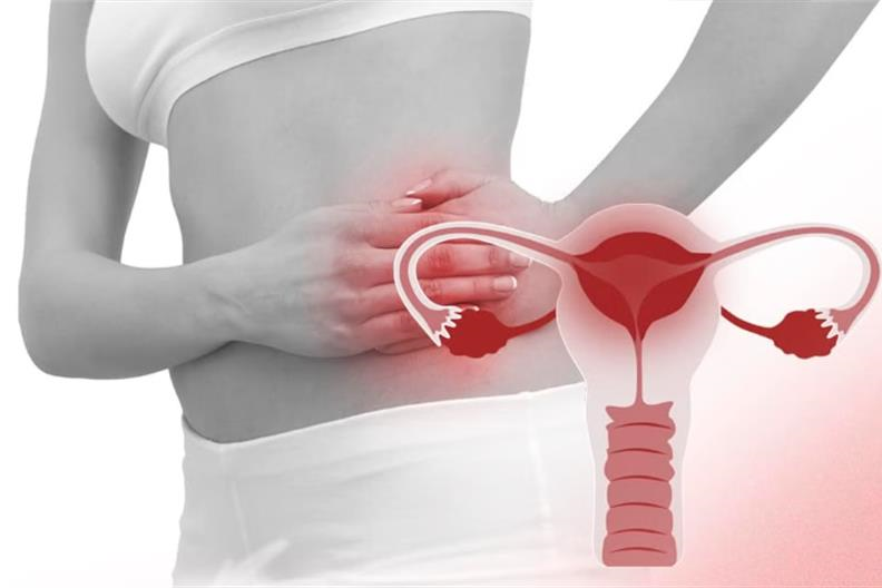 Viêm vùng chậu do đâu? những ảnh hưởng lên chức năng sinh sản ở nữ giới