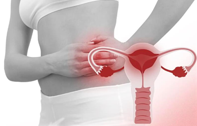 Viêm vùng chậu do đâu? những ảnh hưởng lên chức năng sinh sản ở nữ giới